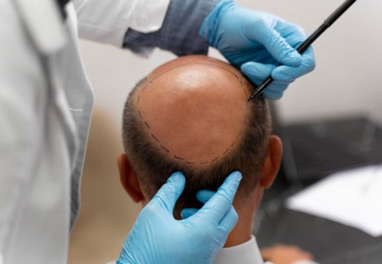 Revitalize Your Look with Our Exclusive Hair Transplant Experience in Istanbul, Turkey!
