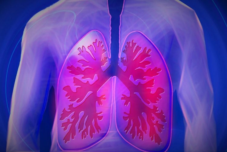 Navigating Lung Cancer: Types, Risks, and Treatments Explained