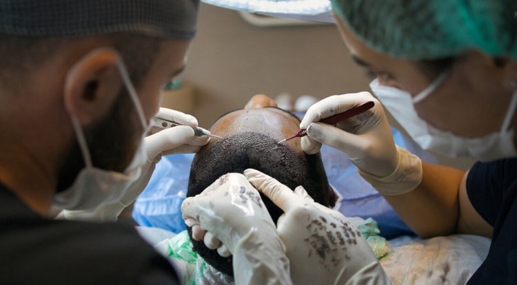 The Best Hair Transplant Techniques: A Comprehensive Guide