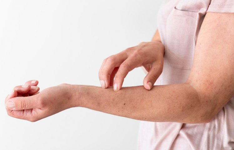  Contact Dermatitis: Causes, Symptoms, Diagnosis, and Treatment