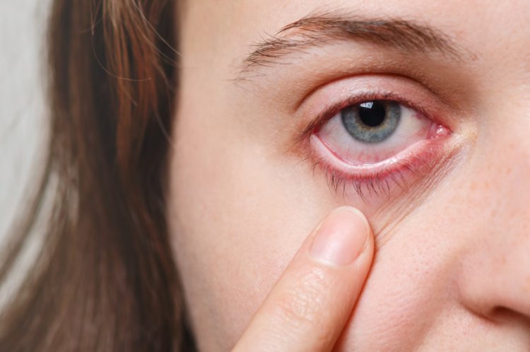 Understanding Uveitis: Causes, Symptoms, Diagnosis, and Treatment