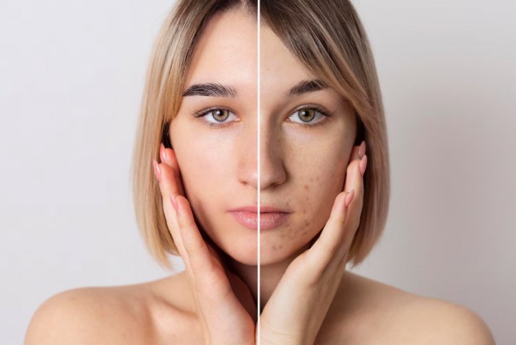 Common Skin Conditions: Understanding, Treatment, and Management