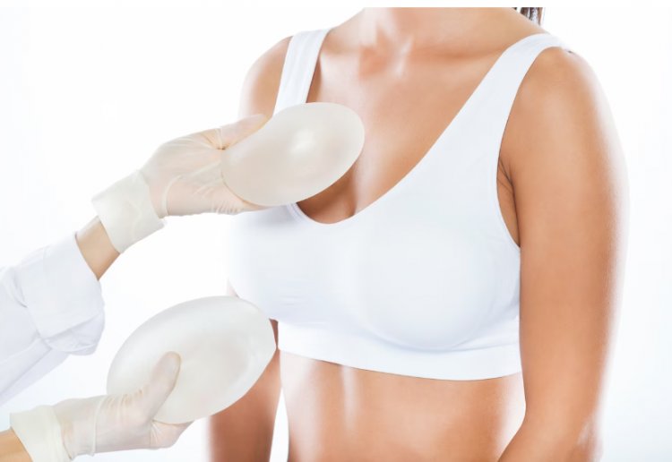 Exploring Breast Implants: A Comprehensive Overview