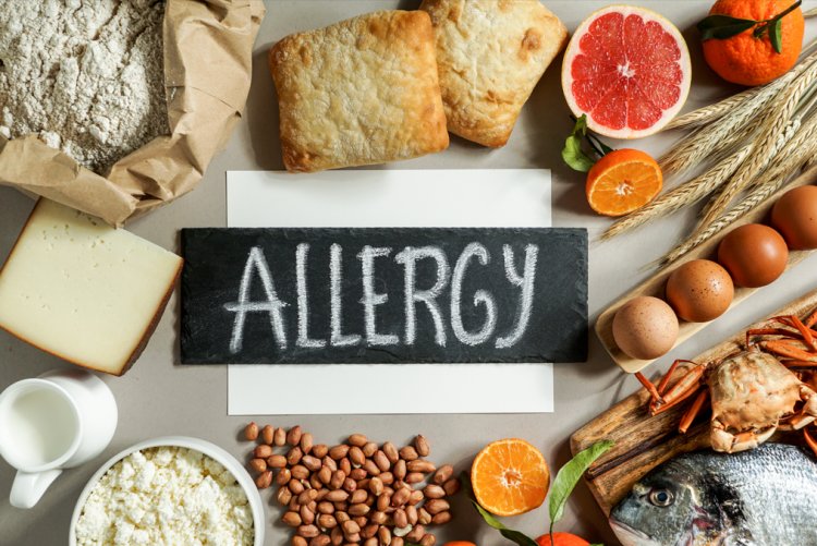 Food Allergies: A Comprehensive Exploration