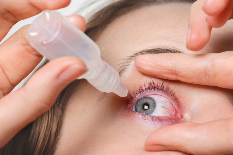 Conjunctivitis Chronicles: From Symptoms to Solutions