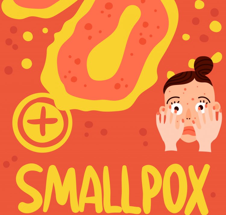 Comprehensive Examination of Smallpox: From Historical Origins to Clinical Manifestations