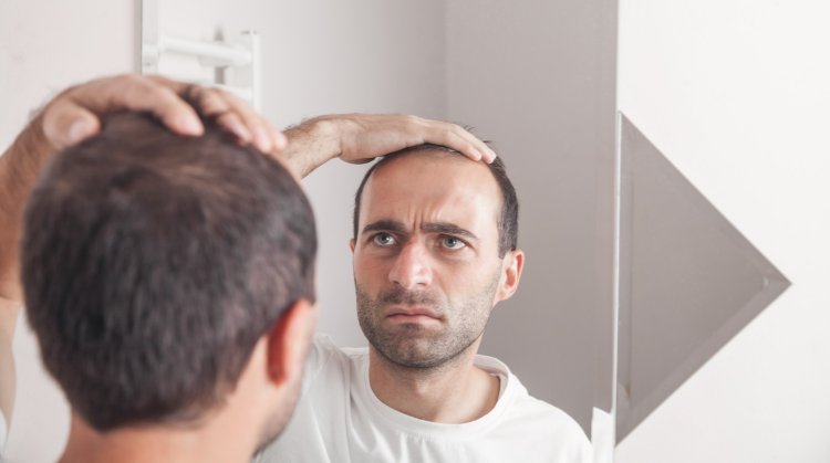 Hair Transplantation: A Comprehensive Guide to Techniques, Innovations, and Patient Considerations