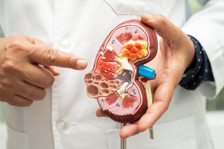 Polycystic Kidney Disease: Diagnosis, Management, and Treatment Options