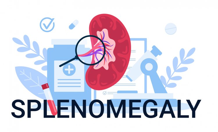 Autoimmune and Inflammatory Causes of Splenomegaly: Diagnosis and Treatment