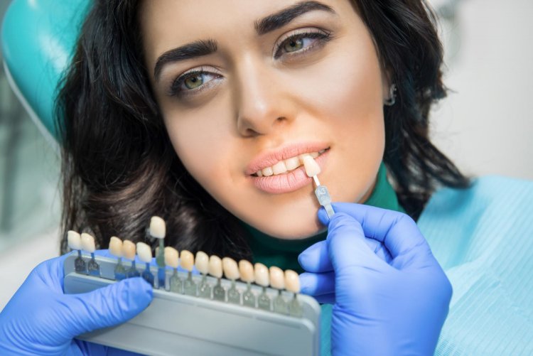 A Closer Look at Composite Fillings: Beauty Meets Functionality