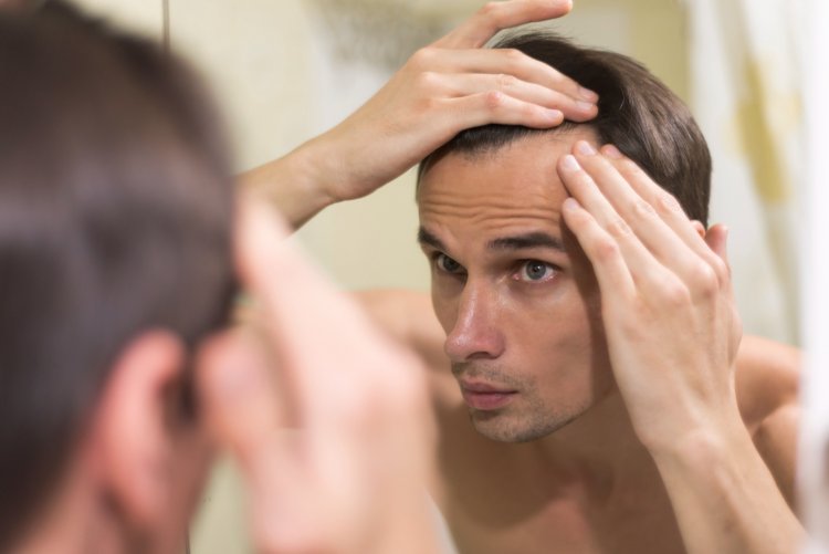 Decoding Male and Female Pattern Hair Loss: Causes and Treatments