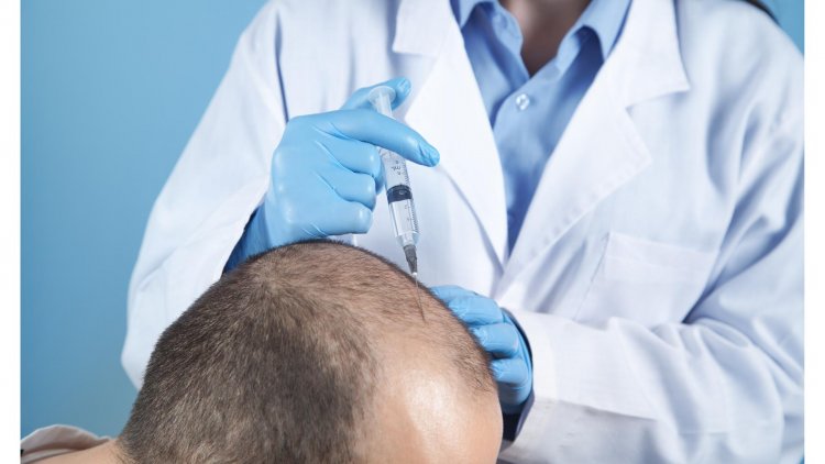 The Hair Transplant Revolution: Transforming Follicles and Lives