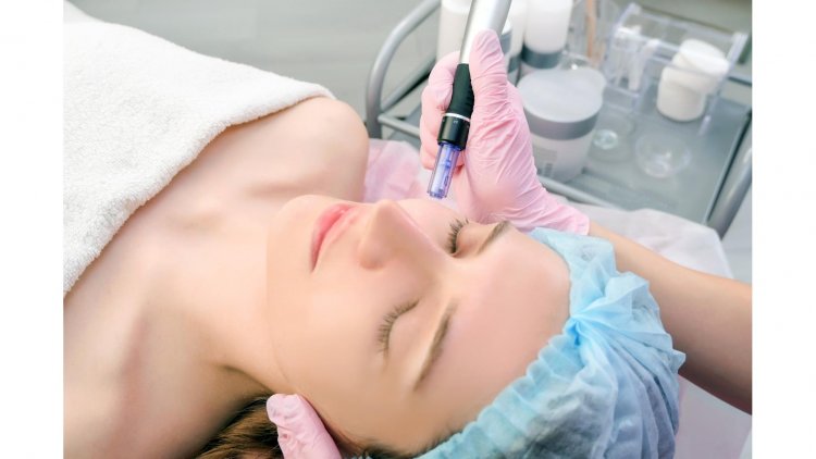 Microneedling Unmasked: The Surprising Truth Behind Popular Myths and Facts