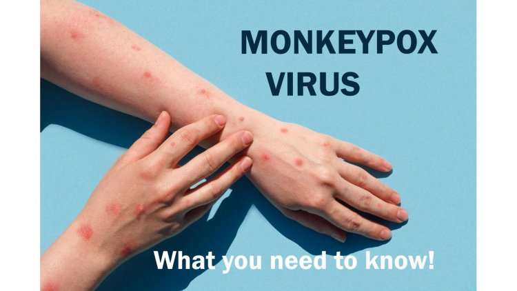 Monkeypox: Unraveling the Mystery of an Ancient Virus in Modern Times